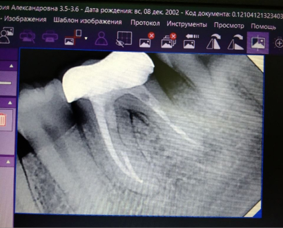 Рентгенография